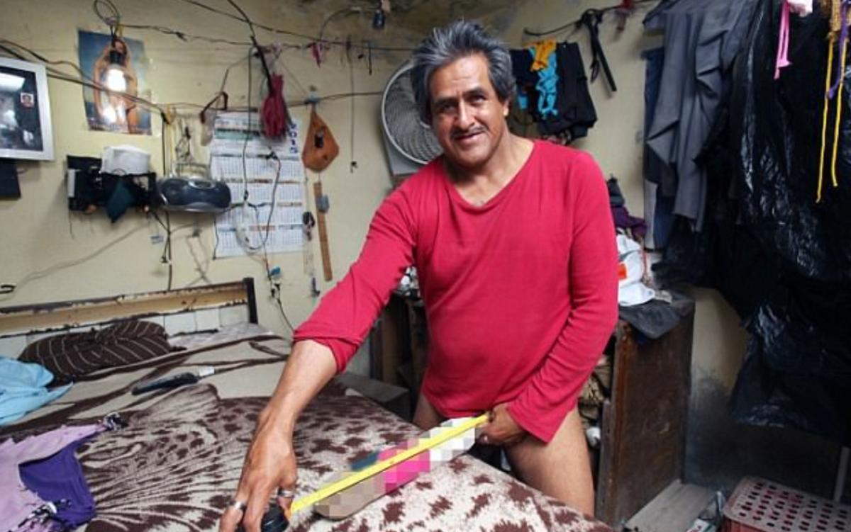 El estremecedor testimonio del hombre con el "pene más grande del mundo