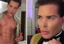 El «Ken humano» sufrió una afección tan grave que decidió renunciar a las cirugías plásticas