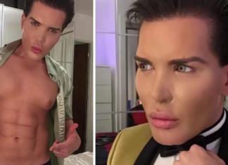 El «Ken humano» sufrió una afección tan grave que decidió renunciar a las cirugías plásticas