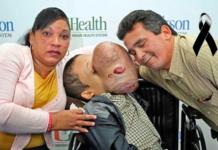 Fallece Emanuel, el niño cubano que tenía un tumor de 4,5 Kilos en su rostro