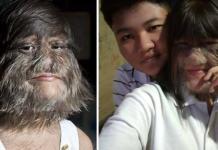 La chica más peluda del mundo se depila para casarse con el amor de su vida