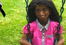 Fallece la adolescente de 19 años que tenía el cuerpo de una anciana de 136