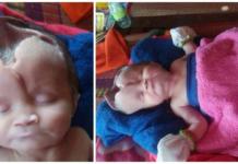 Padres desesperados piden ayuda para salvar a su bebé de 2 meses