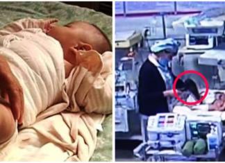 Un recién nacido pierde su pierna después de que una enfermera le quemara con un secador