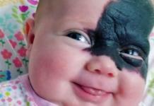 Nace con una marca en su rostro que la convierte en una “superheroína”