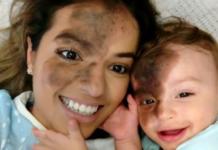 Decide pintar su rostro igual que la marca de nacimiento de su hijo para apoyarlo