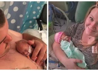 Nace con 411 gramos y logra sobrevivir desafiando los peores pronósticos