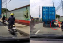 La cabeza de un joven es aplastada por un camión de carga y vive para contarlo