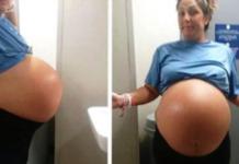 Una madre con un vientre gigante da a luz a la bebé más grande que los doctores hayan visto