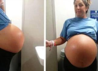 Una madre con un vientre gigante da a luz a la bebé más grande que los doctores hayan visto
