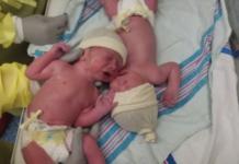 Lo que necesitaban estos gemelos recién nacidos para calmar su llanto dejó a todos atónitos