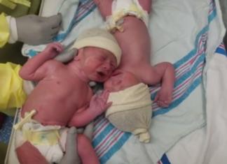 Lo que necesitaban estos gemelos recién nacidos para calmar su llanto dejó a todos atónitos