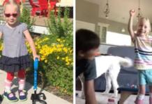 Una niña de 4 años sorprende a los médicos caminando por primera vez tras una cirugía