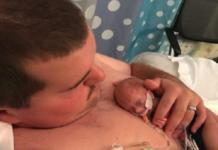 Con 400 gramos y sin esperanzas de vida, esta bebé prematura vence todos los pronósticos