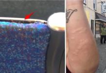 Al sentarse en el autobús sintió que algo le picaba y descubrió una enorme plaga
