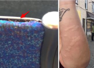 Al sentarse en el autobús sintió que algo le picaba y descubrió una enorme plaga