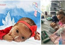 Luciana, la bebé guerrera con un cromosoma extra que en 10 meses de vida inspiró a millones