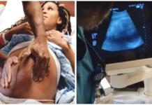 Su bebé venía de nalgas, pero el médico logra girarlo dentro del útero en cuestión de minutos