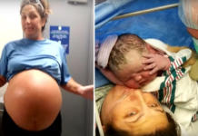 Nace una bebé tan grande que deja perplejos a los médicos y enfermeras en el quirófano