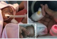 Nace en el quinto mes de gestación pesando 470 gramos, dijeron que no viviría más de 48 horas