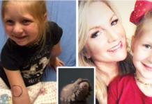 Una niña de 5 años estuvo en peligro de muerte al ser picada por un venenoso animal de jardín