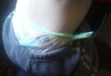 La dramática historia del bebé que usa bolsas plásticas porque su madre no tiene para pañales