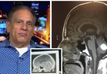 El tumor de un paciente desaparece justo antes de la cirugía ante el asombro de los médicos