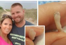 Sufre un aborto espontáneo y publica las desoladoras fotos de su bebé «perfectamente formado»