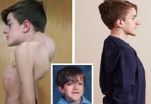 Tras 14 años de sufrimiento logra cambiar su vida después de someterse a 18 cirugías