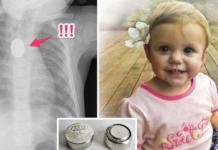 Acuden al hospital con su hija por un simple accidente doméstico y muere a los pocos días