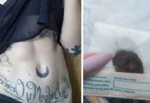 Se opera para quitarse su ombligo y dárselo a su novio -«Lo puse en una bolsita con una nota»