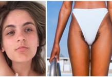 Lucir vello púbico en la playa, la moda de este verano que desata polémica en la red