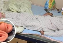 Confunde los juguetes eróticos de su nieto con calcetines y se le atascan en los pies