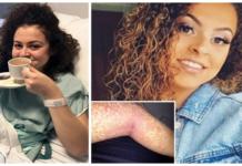 Un síntoma común después de rasurarse fue su salvación para descubrir que tenía cáncer