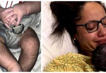 Le da a su bebé la medicina que salvaría su vida y no deja de crecerle pelo en todos lados