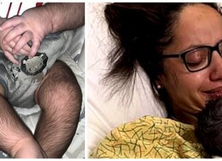 Le da a su bebé la medicina que salvaría su vida y no deja de crecerle pelo en todos lados