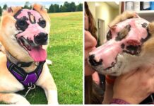 Sobrevivió a una pesadilla entre las llamas, pero ahora consuela a otras víctimas como él