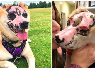 Sobrevivió a una pesadilla entre las llamas, pero ahora consuela a otras víctimas como él