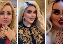 Joven se realiza 43 cirugías para convertirse en una Barbie humana pero la llaman “zombi”